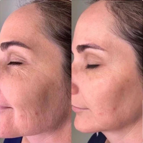 Slicklift EMS Face Massager